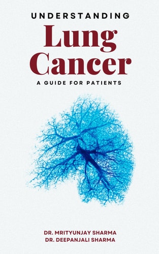 Understanding Lung Cancer A Guide for Patients