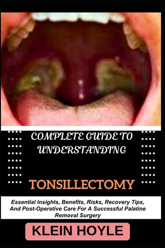 Complete Guide to Understanding Tonsillectomy Essential Insights, Benefits, Risks, Recovery Tips, And Post-Operative Care For A Successful Palatine Removal Surgery