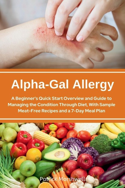 Alpha-Gal Allergy: A Beginners Quick Start Overview and Guide to Managing the Condition Through Diet, with Sample Meat-Free Recipes and a 7-Day Meal Plan