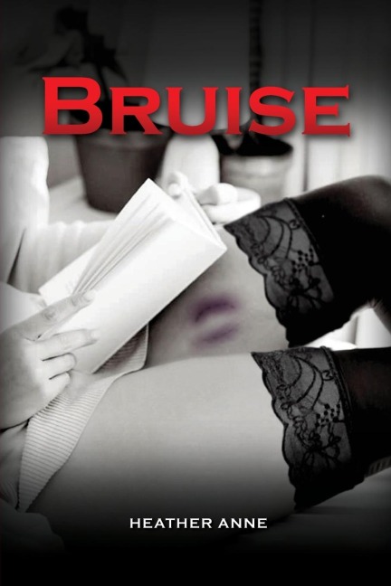 Bruise