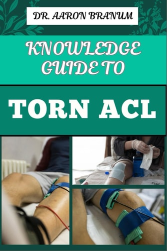 Knowledge Guide to Torn ACL Essential Manual To Symptoms, Treatment Options, Recovery Exercises, And Prevention Strategies For Knee Ligament And Sports Injuries Management