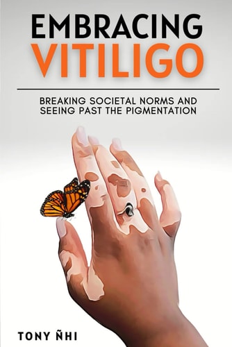 Embracing Vitiligo Breaking Societal Norms and Seeing Past the Pigmentation: Finding Self-confidence with Vitiligo & 100 Affirmations for Embracing the Skin You're in