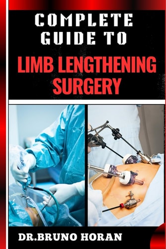Complete Guide to Limb Lengthening Surgery Essential Handbook To Modern Techniques, Recovery, And Best Practices For Optimal Results
