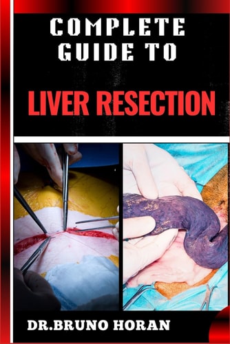 Complete Guide to Liver Resection Detailed Guide To Hepatic Surgery, Recovery, Post Op Care, Complications, And Diet Management