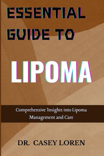 Essential Guide to Lipoma Comprehensive Insights Into Lipoma Management and Care