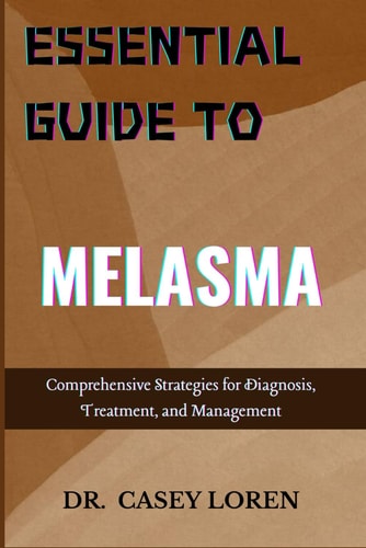 Essential Guide to Melasma Comprehensive Strategies for Diagnosis, Treatment, and Management