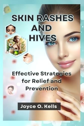 Skin Rashes and Hives Effective Strategies for Relief and Prevention