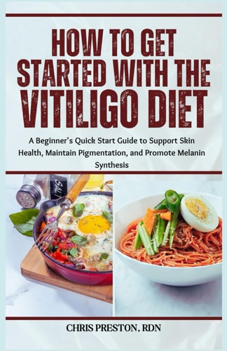 How to Get Started with the Vitiligo Diet A Beginner's Quick Start Guide to Support Skin Health, Maintain Pigmentation, and Promote Melanin Synthesis