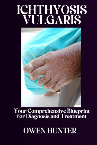 Ichthyosis Vulgaris Your Comprehensive Blueprint for Diagnosis and Treatment