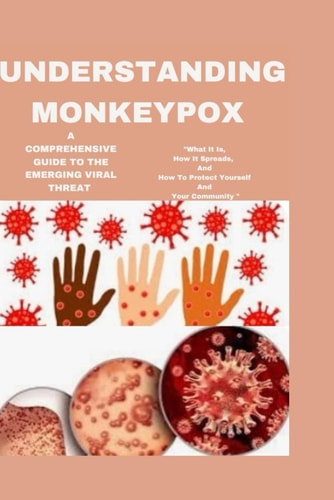 Understanding Monkeypox A Comprehensive Guide to the Emerging Viral Threat: "What It Is, How It Spreads, and How to Protect Yourself and Your Community"
