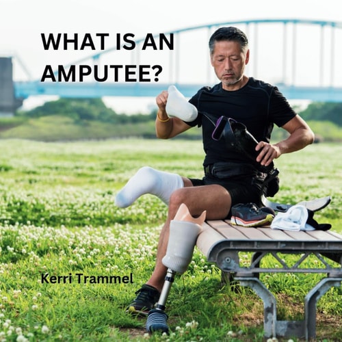 What Is An Amputee?