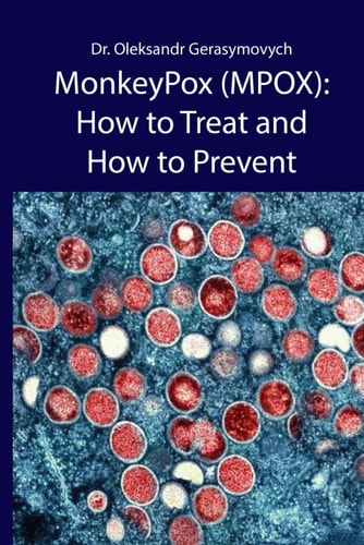 MonkeyPox (MPOX) How to Treat and How to Prevent