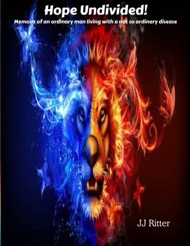 Hope Undivided CRPS: Memoirs of an Ordinary Man Living with a Not So Ordinary Disease.