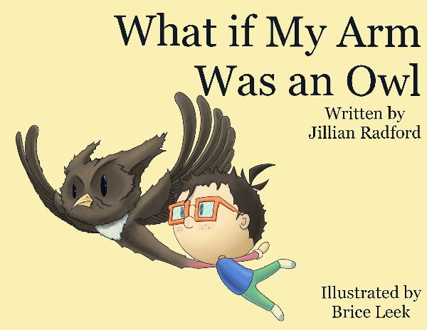 What if my Arm was an Owl?