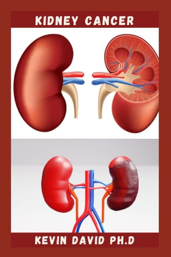 Kidney Cancer Step By Step Guide On How To Heal Your Kidney And Live Healthily
