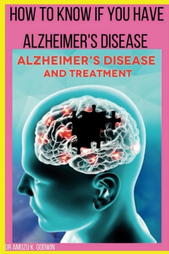 How to Know If You Have Alzheimers Disease Sign And Symptoms for Alzheimer's Disease