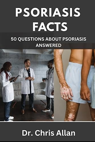 Psoriasis Facts 50 Questions about Psoriasis Answered.
