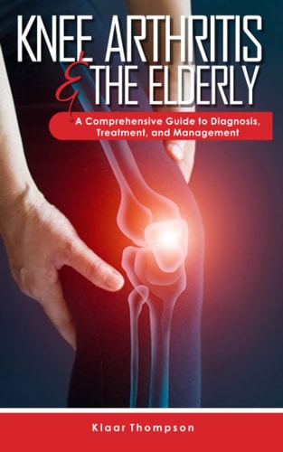 Knee Arthritis &The Elderly A Comprehensive Guide to Diagnosis, Treatment, and Management