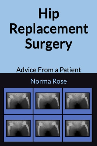 Hip Replacement Surgery Advice From a Patient