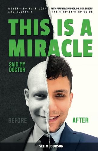 This Is a Miracle Said My Doctor Reversing Hair Loss and Alopecia
