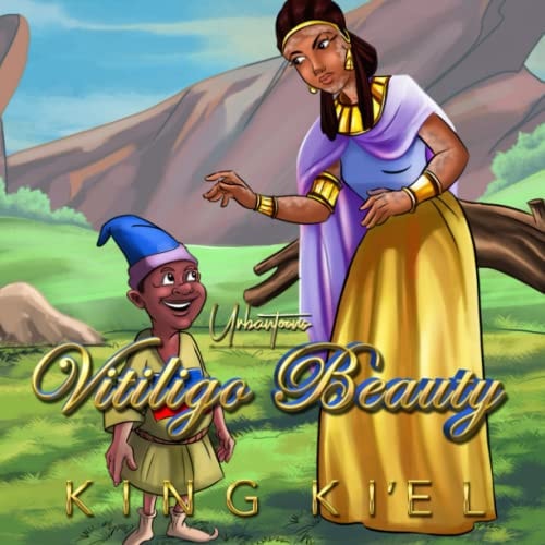 Vitiligo Beauty A Retelling of Snow White
