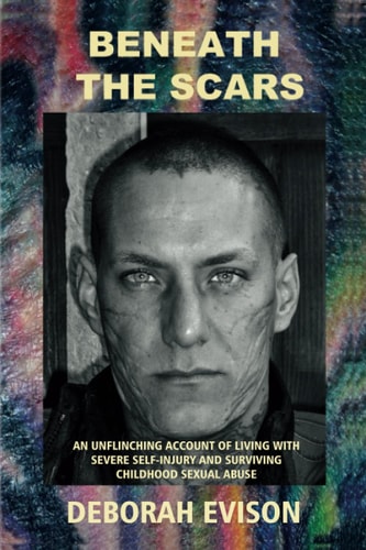 Beneath the Scars An Unflinching Account of Living with Severe Self-injury and Surviving Childhood Sexual Abuse