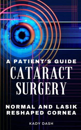 A Patient's Guide to Cataract Surgery Normal and LASIK Reshaped Cornea