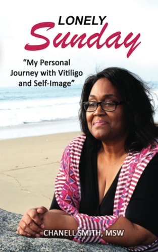 Lonely Sunday My Personal Journey with Vitiligo and Self-Image