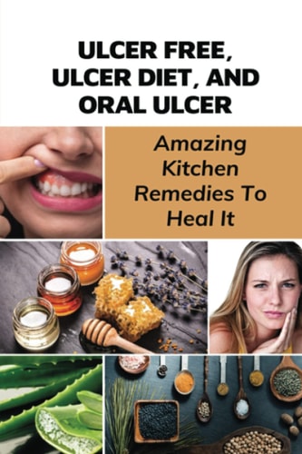 Ulcer Free, Ulcer Diet, And Oral Ulcer Amazing Kitchen Remedies To Heal It: How Do You Get Rid Of Mouth Ulcers Overnight?