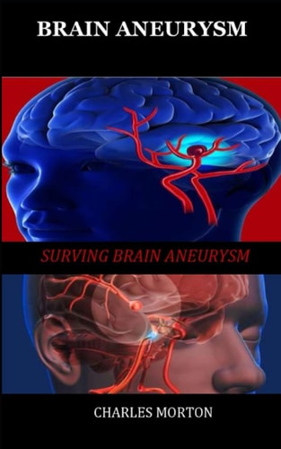 Brain Aneurysm Surviving Aneurysm