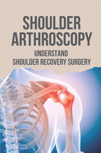 Shoulder Arthroscopy Understand Shoulder Recovery Surgery: Shoulder Surgery Rehibilitation