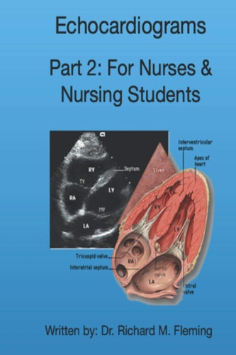 ECHOCARDIOGRAMS - PART 2 For Nurses & Nursing Students
