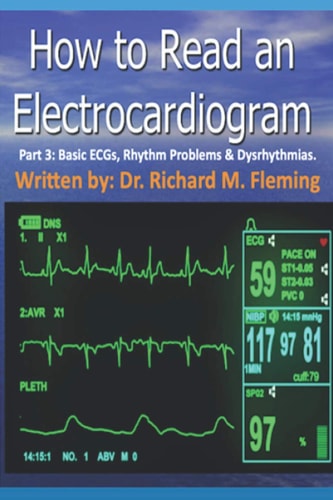 How to Read an Electrocardiogram - Part 3 Basic ECGs, Rhythm Problems & Dysrhythmias.