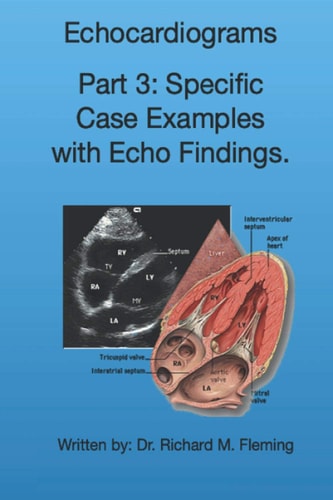 ECHOCARDIOGRAMS - PART 3 Specific Case Examples with Echo Findings