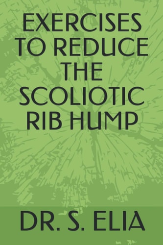 Exercises to Reduce the Scoliotic Rib Hump