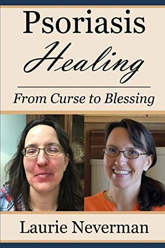 Psoriasis Healing From Curse to Blessing