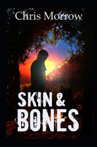 Skin & Bones