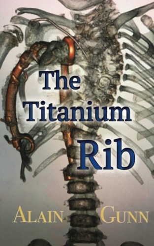 The Titanium Rib
