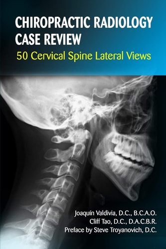 Chiropractic Radiology Case Review 50 Cervical Spine Lateral Views