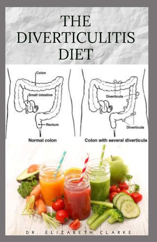 The Diverticulitis Diet Easy Diet Guide for People with Diverticulitis: Includes Delicious Recipe Food List Meal Plan and Cookbook
