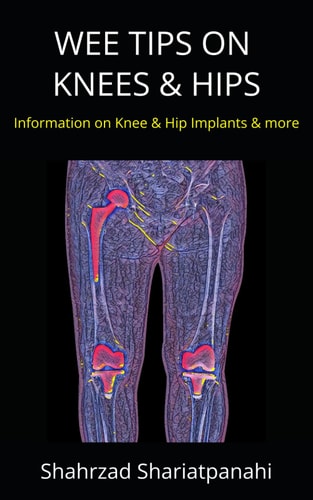 WEE TIPS on KNEES and HIPS Information on Knee and Hip Implants and More