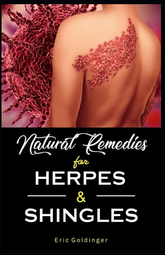 Natural Remedies For HERPES & SHINGLES The Complete Guide