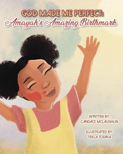 God Made Me Perfect Amayah's Amazing Birthmark