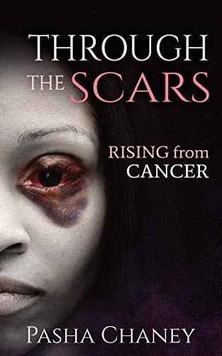 Through the Scars Rising from Cancer
