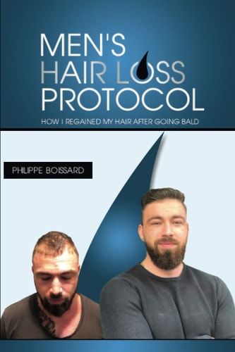 Men's Hairloss Protocol How i Regained My Hair After Going Bald