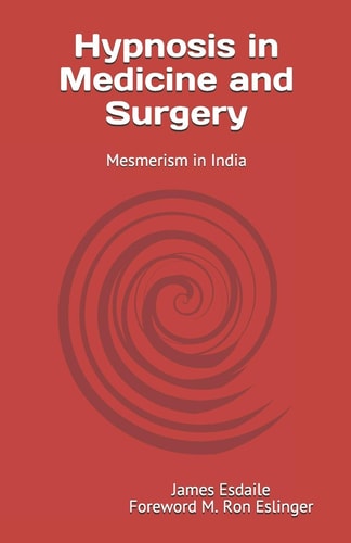 Hypnosis in Medicine and Surgery Mesmerism in India