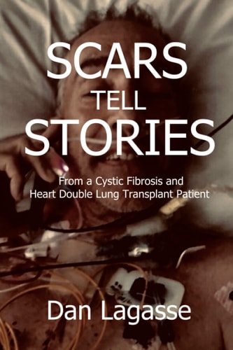 Scars Tell Stories From a Cystic Fibrosis and Heart/Double Lung Transplant Patient