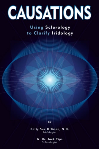 Causations Using Sclerology to Clarify Iridology