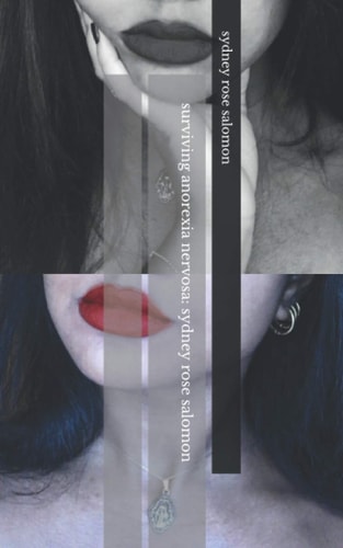 Surviving Anorexia Nervosa Sydney Rose Salomon