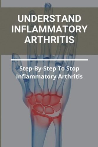 Understand Inflammatory Arthritis Step-By-Step To Stop Inflammatory Arthritis: Unusual Symptoms Of Rheumatoid Arthritis